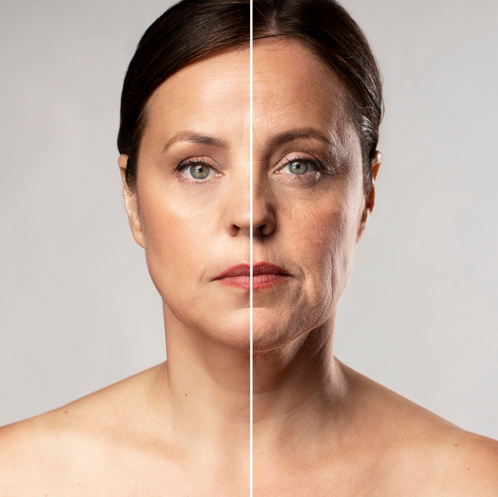 Facelift öncesi