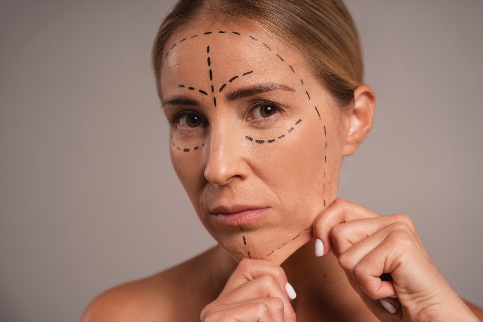 Facelift & Neck Lift