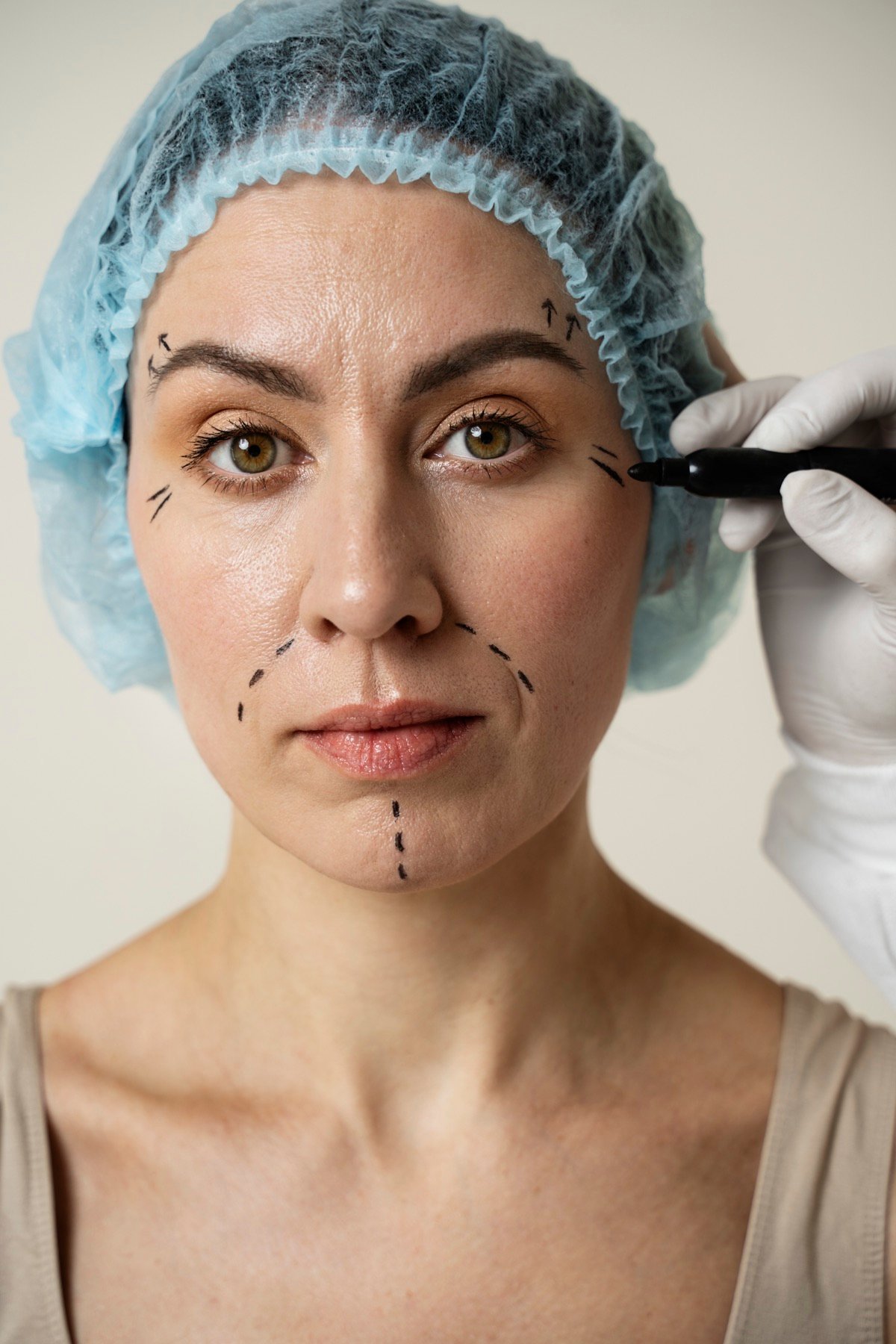 Facelift & Neck Lift