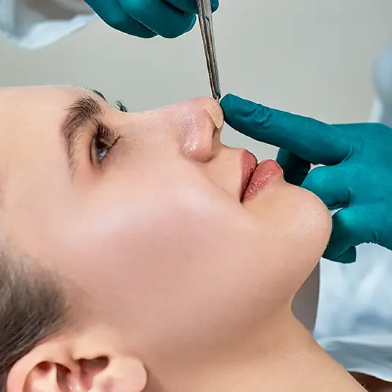 revizyon rhinoplasty