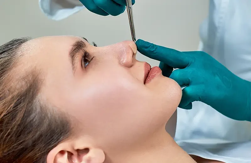 revizyon rhinoplasty revizyon rhinoplasty